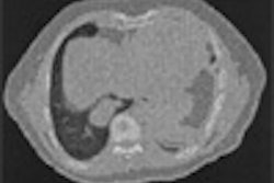 2005 07 20 09 33 18 706