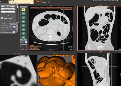 2006 05 04 11 14 28 706