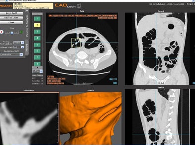 2006 05 04 11 20 16 706