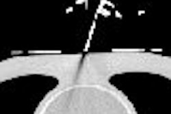 2006 09 18 13 51 52 706