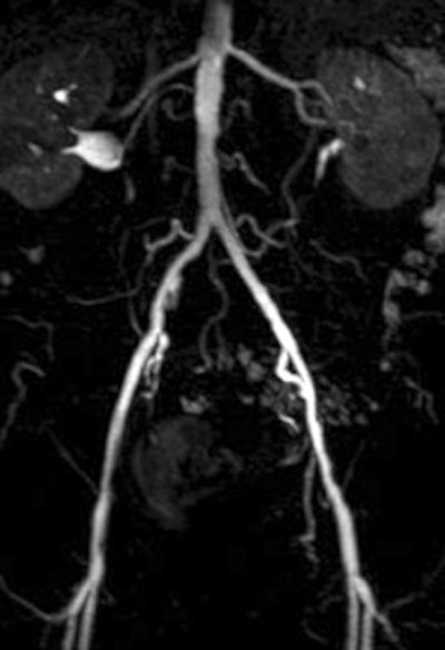 2007 03 19 13 56 50 706