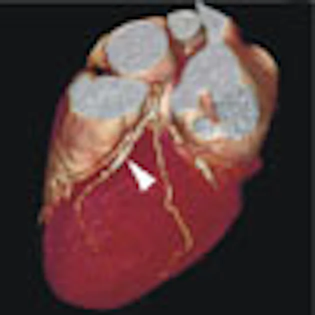 Chestrad Dual-source CT edges into cardiac SPECT turf | AuntMinnieEurope