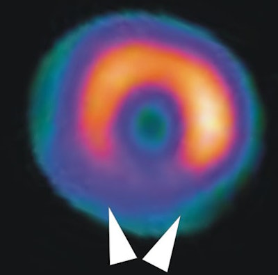 2008 03 05 17 00 06 706