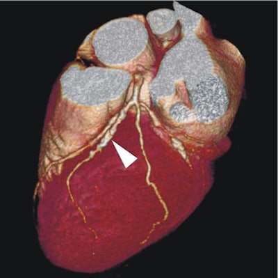 2008 03 05 17 00 36 706