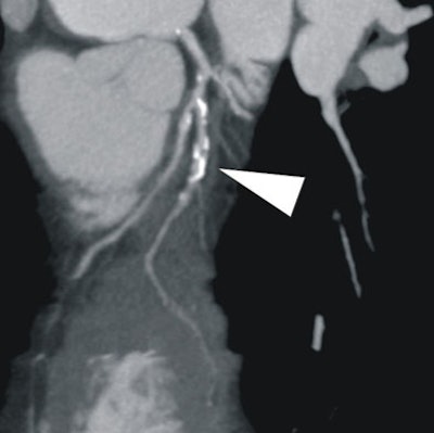 2008 03 05 17 00 49 706