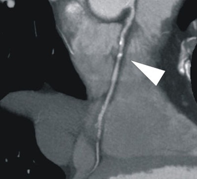 2008 03 05 17 01 43 706