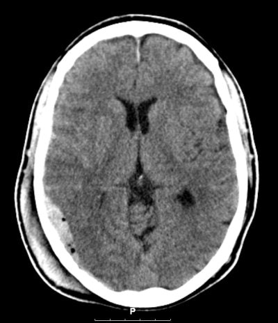 2008 03 07 12 00 43 706