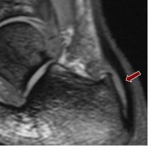 2008 03 10 00 05 16 706