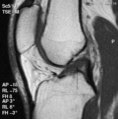 2008 04 02 15 06 01 706