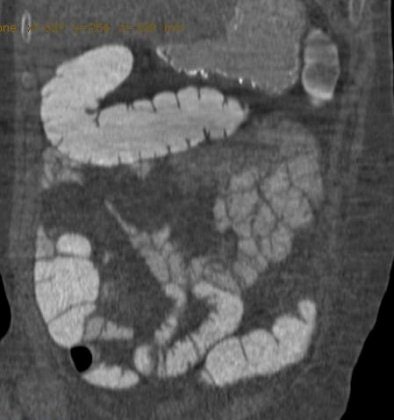 2008 04 15 15 23 03 706