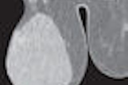 2008 06 18 10 48 58 596 Figure1 Thumb