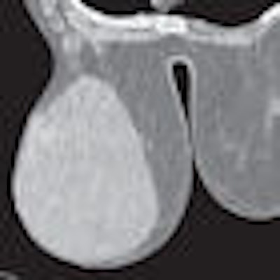 2008 06 18 10 48 58 596 Figure1 Thumb