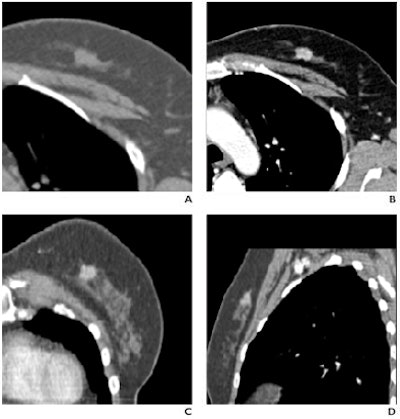 2008 06 18 21 17 38 278 2008 06 18 Figure6c
