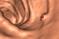 2008 06 23 13 59 51 502 Burling thumb 07 08