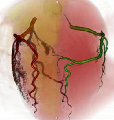 2008 06 27 12 48 22 909 Wang bottomvrt jpg