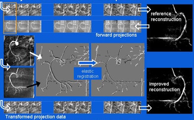 2008 07 09 10 26 48 12 Hansis motioncompensation