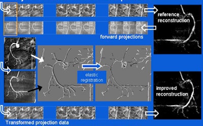 2008 07 09 10 26 48 12 Hansis motioncompensation