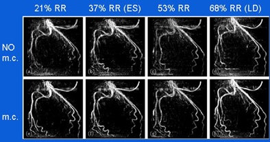 2008 07 09 10 26 50 330 Hansis example2