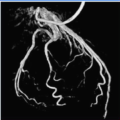 2008 07 09 10 26 51 414 Hansis 68percent