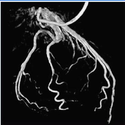 2008 07 09 10 26 51 414 Hansis 68percent