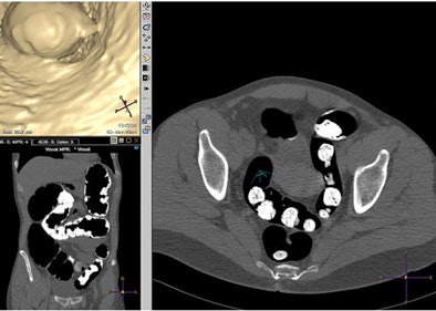 2008 07 15 13 24 00 512 Jensch figb1