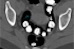 2008 07 15 13 24 02 147 Jensch thumb 07 08