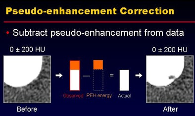 2008 07 29 11 21 51 676 Nappi top pseudocorrection