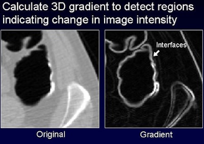 2008 07 29 11 21 59 720 Nappi below pvinterface