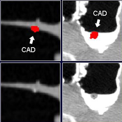 2008 07 29 11 22 00 974 Nappi beforeandafter