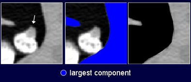 2008 07 29 11 22 01 297 Nappi wallconnection