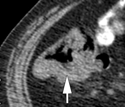 2008 08 25 14 58 45 894 Goh1 Atop Resized