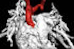 2008 08 28 14 18 36 368 Ped Mri Thumb