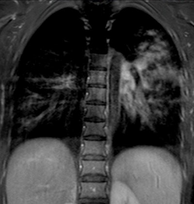 2008 10 15 17 28 53 950 2008 10 16 Peltola2 B Resizedv2