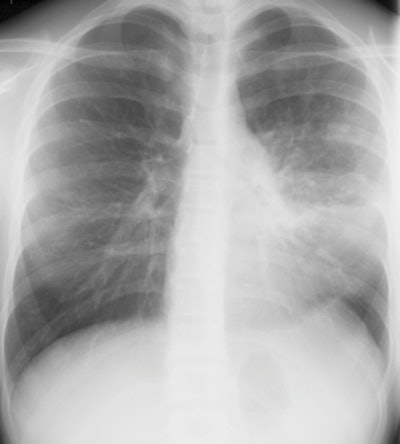 2008 10 15 17 28 56 494 2008 10 16 Peltola2 A Resizedv2