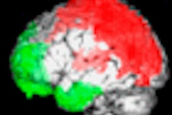 2008 10 31 14 13 54 360 Fibromyalgia Thumb