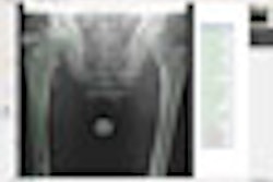 2008 11 03 10 40 38 570 Rsa Thumb Paa 2008