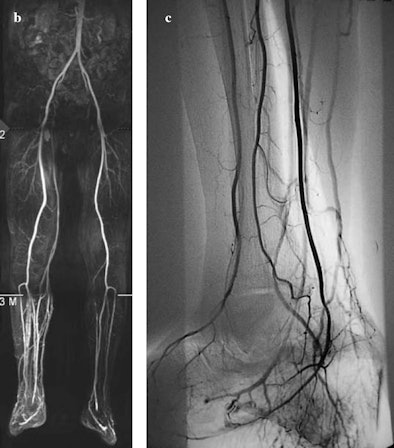 2008 11 04 16 03 38 281 Image Bc Osteo