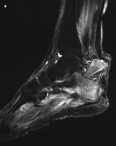 2008 11 04 16 03 39 803 Image A Osteo