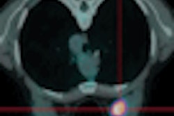 2008 11 17 15 20 23 842 Figure4 B Thumb