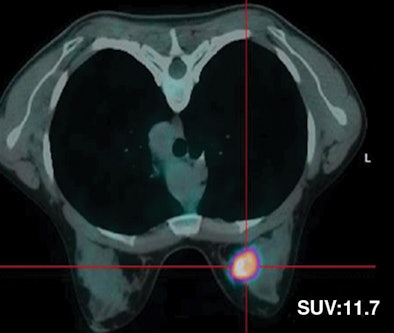 2008 11 17 15 20 24 92 Figure4 B Resized