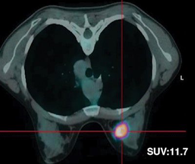 2008 11 17 15 20 24 92 Figure4 B Resized