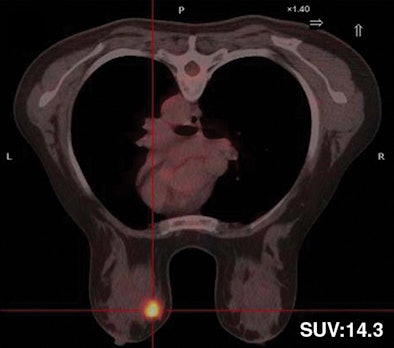 2008 11 17 15 20 30 168 Figure3 B Resized