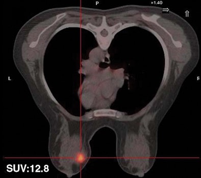 2008 11 17 15 20 33 425 Figure3 A Resized