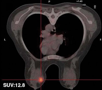 2008 11 17 15 20 33 425 Figure3 A Resized