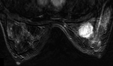 2008 11 17 15 20 34 700 Figure4 C Resized