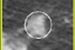 2008 11 24 15 01 40 953 Diciotti thumb 11 08