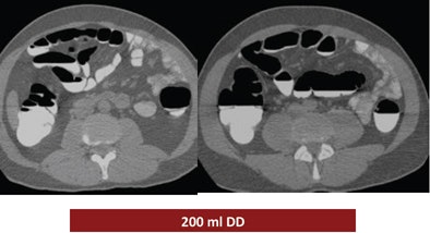 2008 12 15 15 02 21 536 Ferrari exampletop