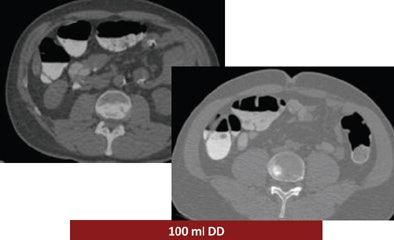 2008 12 15 15 02 22 69 Ferrari examplemiddle