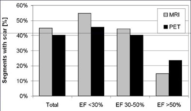 2009 01 02 15 18 12 393 Hunold scardetection
