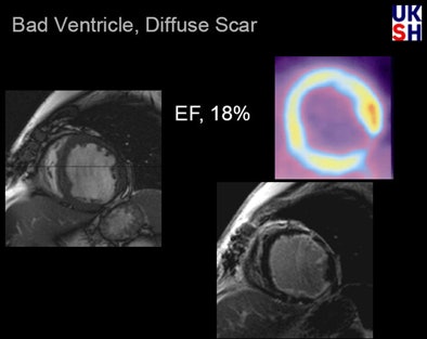 2009 01 02 15 20 49 150 Hunold patient18